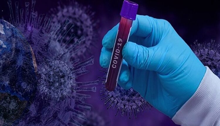 छत्तीसगढ़ में कोरोना का उफान जारी, 15256 नए मरीज, 105 मौतें