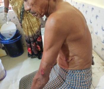 भालू का डटकर मुकाबला करते बुजुर्ग जख्मी