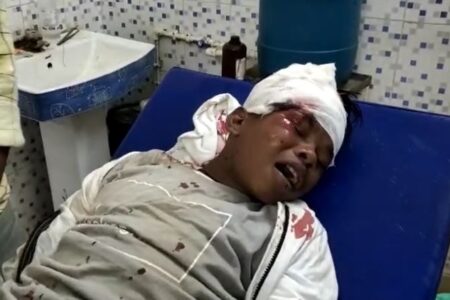 सहदेव दिरदो सड़क हादसे में बुरी तरह जख्मी